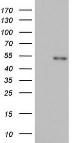 NR2C1 Antibody in Western Blot (WB)
