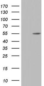 NR2C1 Antibody in Western Blot (WB)