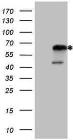 NR2C2 Antibody in Western Blot (WB)