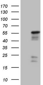 NR2E3 Antibody in Western Blot (WB)