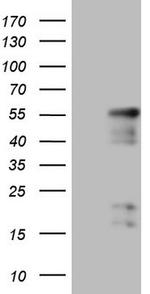 NR2E3 Antibody in Western Blot (WB)