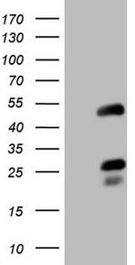 NR2F6 Antibody in Western Blot (WB)