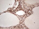 NR3C1 Antibody in Immunohistochemistry (Paraffin) (IHC (P))