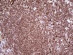NR3C1 Antibody in Immunohistochemistry (Paraffin) (IHC (P))