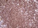 NR3C1 Antibody in Immunohistochemistry (Paraffin) (IHC (P))