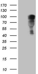 NR3C1 Antibody in Western Blot (WB)