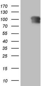 NR3C1 Antibody in Western Blot (WB)