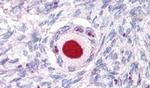 NR5A1 Antibody in Immunohistochemistry (Paraffin) (IHC (P))