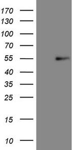 NR5A1 Antibody in Western Blot (WB)