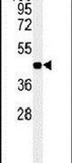 NR5A1 Antibody in Western Blot (WB)