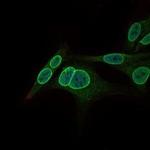 GCNF Monoclonal Antibody (4G8)