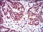 GCNF Antibody in Immunohistochemistry (Paraffin) (IHC (P))