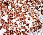 NRBP Antibody in Immunohistochemistry (IHC)