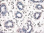 NRBP1 Antibody in Immunohistochemistry (Paraffin) (IHC (P))