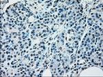 NRBP1 Antibody in Immunohistochemistry (Paraffin) (IHC (P))