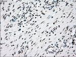 NRBP1 Antibody in Immunohistochemistry (Paraffin) (IHC (P))