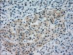 NRBP1 Antibody in Immunohistochemistry (Paraffin) (IHC (P))