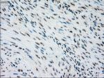 NRBP1 Antibody in Immunohistochemistry (Paraffin) (IHC (P))