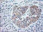 NRBP1 Antibody in Immunohistochemistry (Paraffin) (IHC (P))