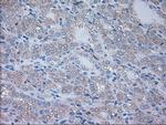 NRBP1 Antibody in Immunohistochemistry (Paraffin) (IHC (P))