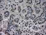 NRBP1 Antibody in Immunohistochemistry (Paraffin) (IHC (P))