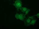 NSMCE2 Antibody in Immunocytochemistry (ICC/IF)