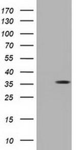 NSMCE2 Antibody in Western Blot (WB)