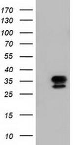 NSMCE2 Antibody in Western Blot (WB)
