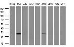 NSMCE2 Antibody in Western Blot (WB)