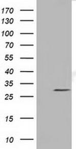 NSMCE2 Antibody in Western Blot (WB)