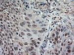 NT3 Antibody in Immunohistochemistry (Paraffin) (IHC (P))