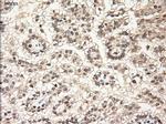 NT3 Antibody in Immunohistochemistry (Paraffin) (IHC (P))