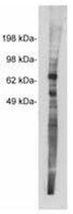 NTN1 Polyclonal Antibody