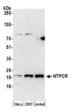 NTPCR Polyclonal Antibody