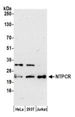 NTPCR Polyclonal Antibody