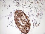 NTRK1 Antibody in Immunohistochemistry (Paraffin) (IHC (P))