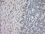 NTRK3 Antibody in Immunohistochemistry (Paraffin) (IHC (P))