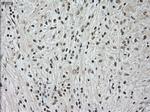 NTRK3 Antibody in Immunohistochemistry (Paraffin) (IHC (P))