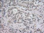 NTRK3 Antibody in Immunohistochemistry (Paraffin) (IHC (P))