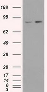NTRK3 Antibody in Western Blot (WB)