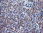 NUBPL Antibody in Immunohistochemistry (Paraffin) (IHC (P))
