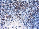 NUBPL Antibody in Immunohistochemistry (Paraffin) (IHC (P))