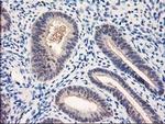 NUBPL Antibody in Immunohistochemistry (Paraffin) (IHC (P))