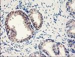 NUBPL Antibody in Immunohistochemistry (Paraffin) (IHC (P))