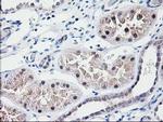 NUBPL Antibody in Immunohistochemistry (Paraffin) (IHC (P))