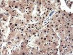 NUBPL Antibody in Immunohistochemistry (Paraffin) (IHC (P))