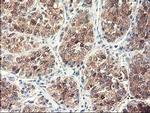 NUBPL Antibody in Immunohistochemistry (Paraffin) (IHC (P))