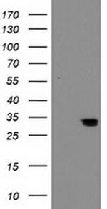 NUBPL Antibody in Western Blot (WB)