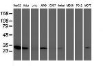 NUBPL Antibody in Western Blot (WB)