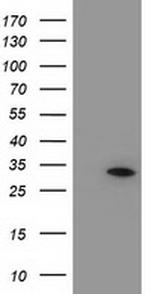 NUBPL Antibody in Western Blot (WB)